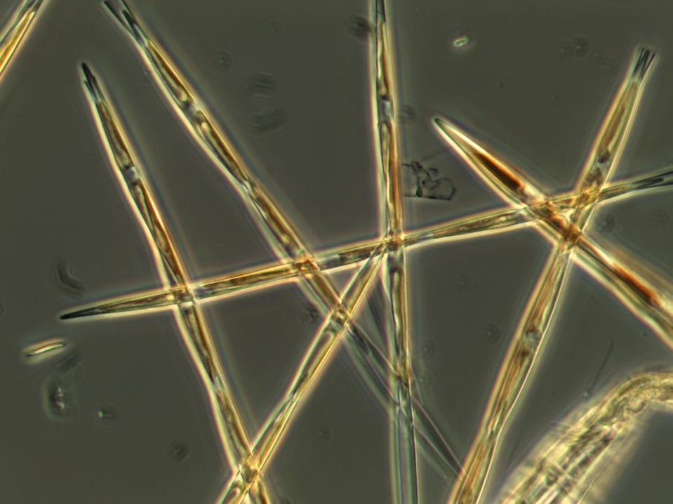 Toxic Algae Bloom Spreads From California To Alaska