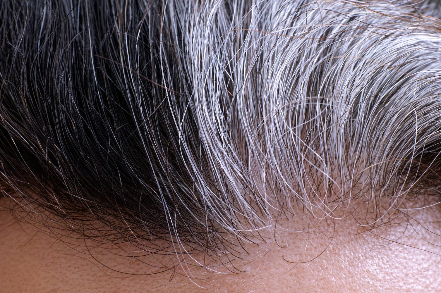 Accidental discovery could mean a cure for balding, gray hair