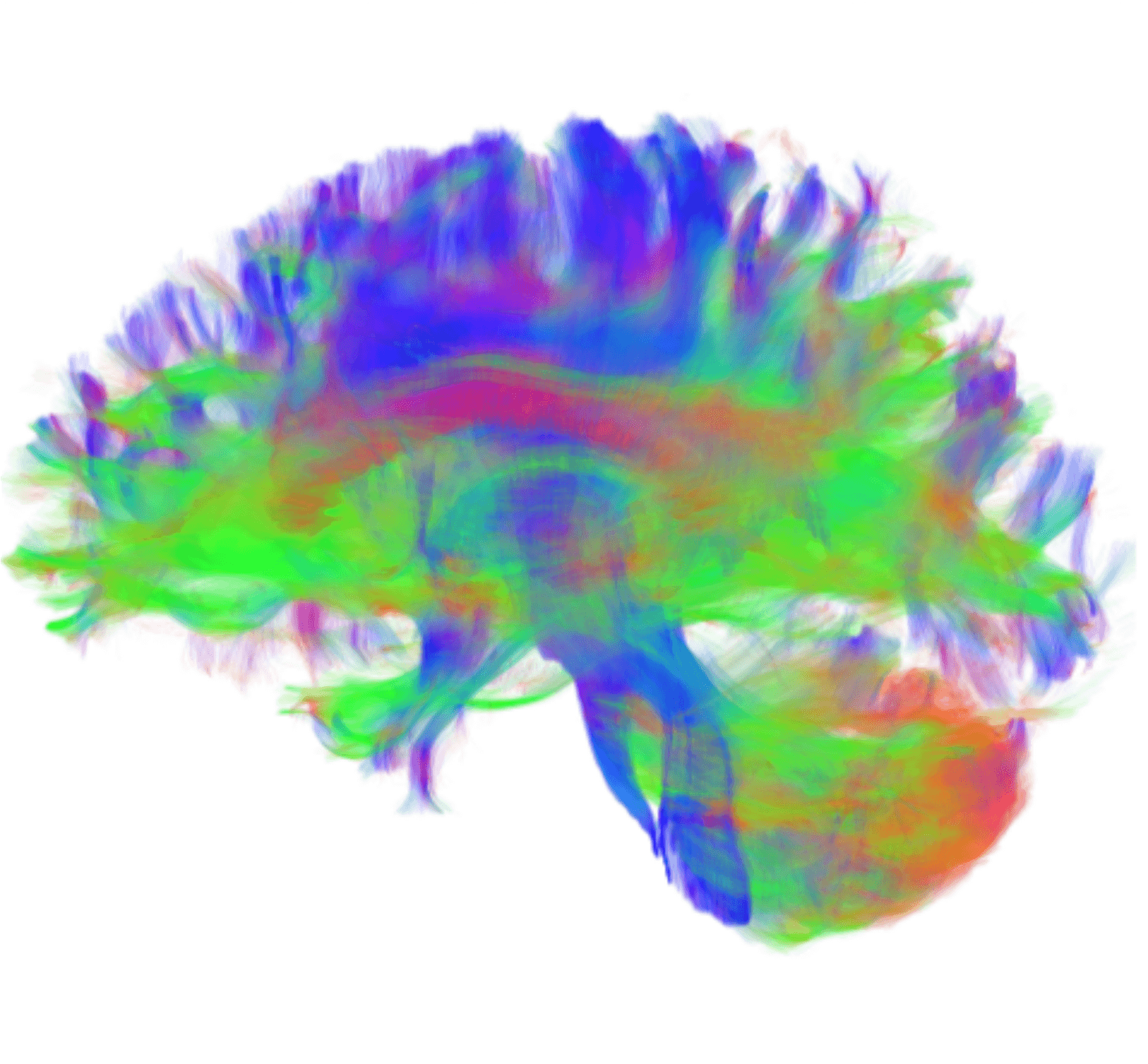 How the brain controls impulses to make good decisions