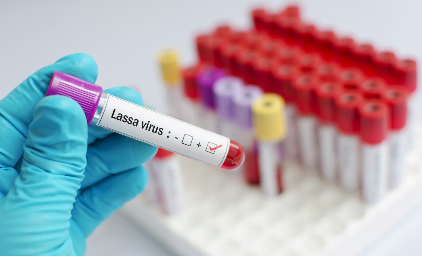 Lassa fever risk could increase dramatically in Africa