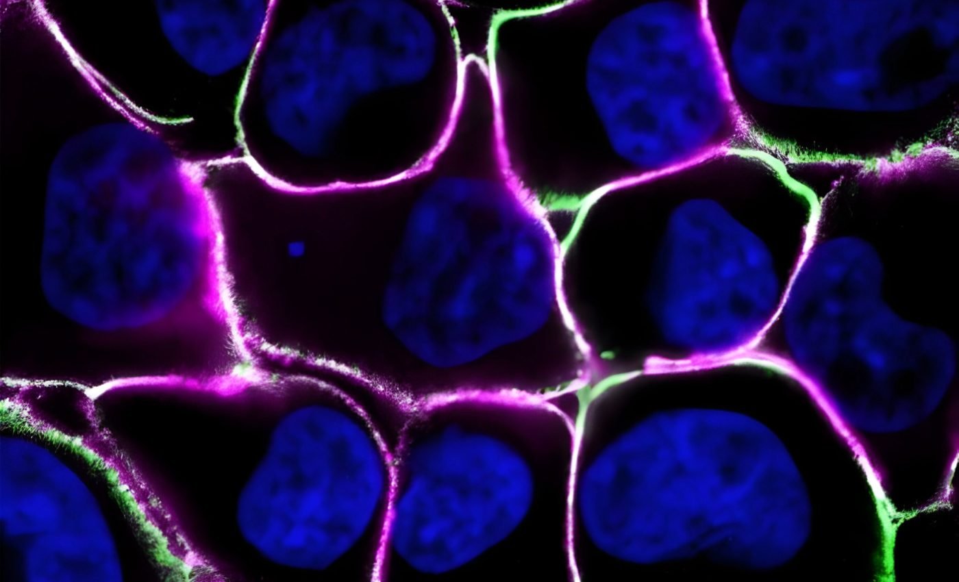 Cancer cells collaborate to survive challenging conditions