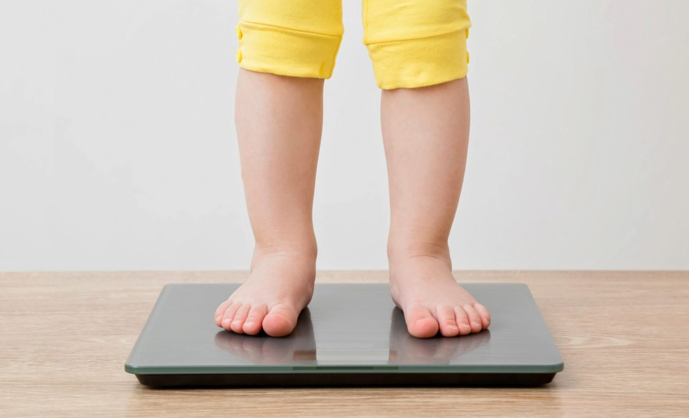 Global childhood obesity rate is expected to soar by 2050