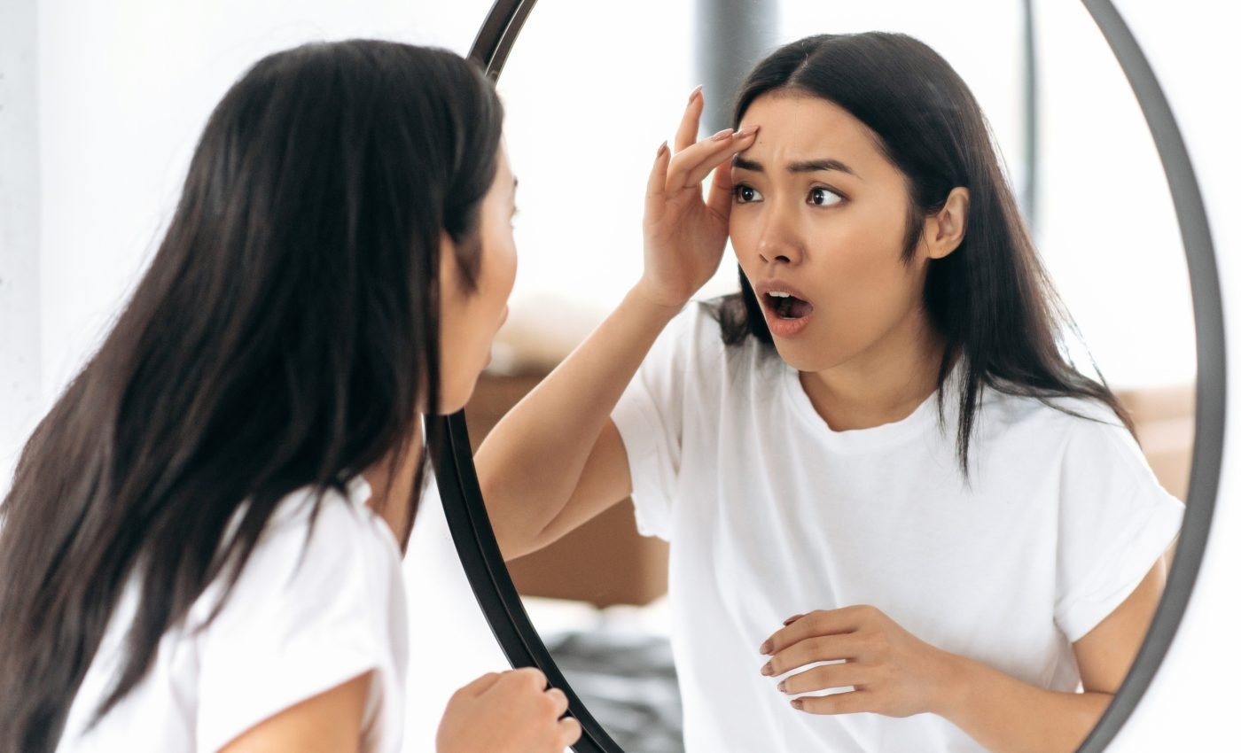 Pimples may soon be a thing of the past with new medical patch
