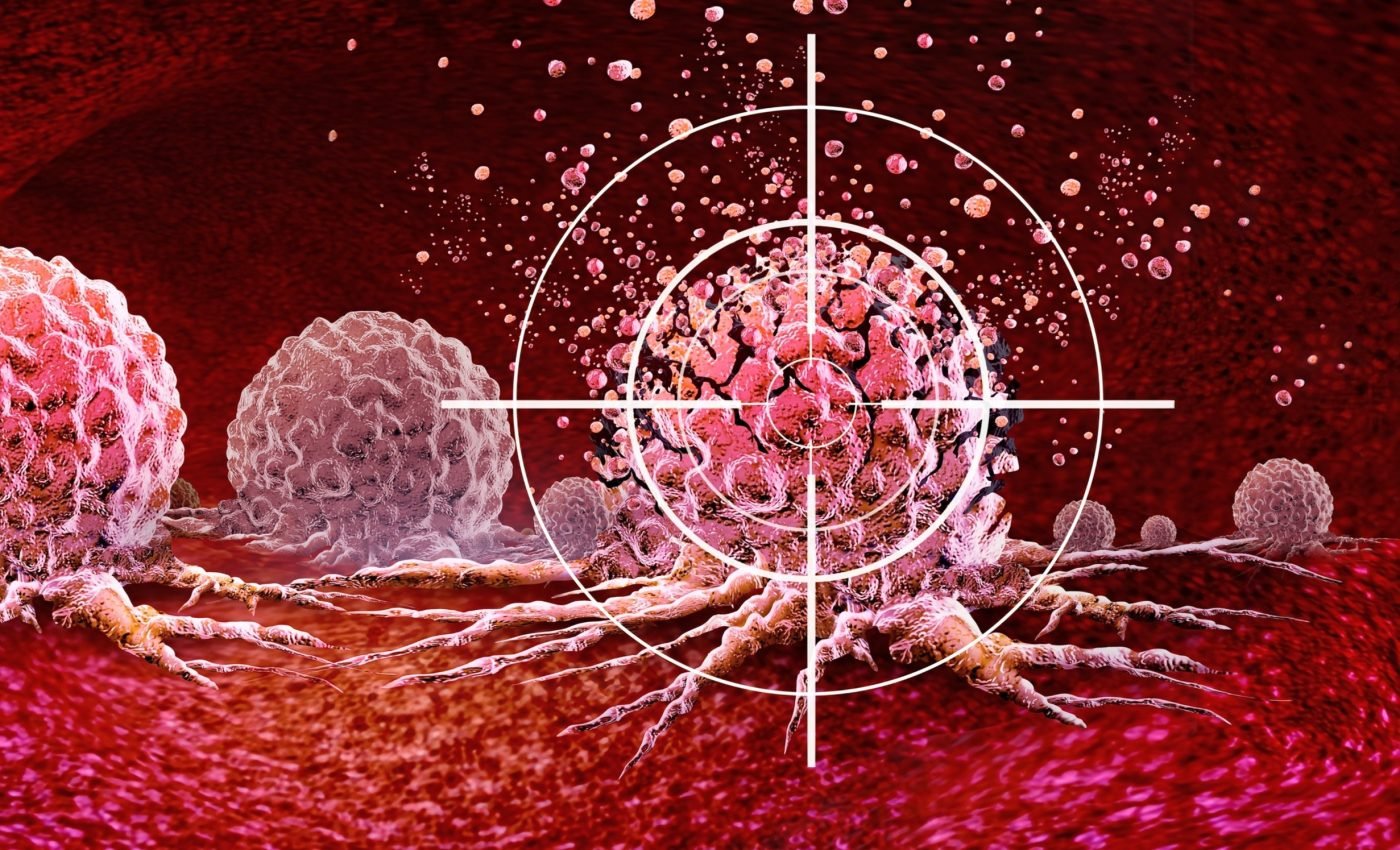 Freezing molecules could halt the spread of brain cancer